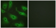 AP32223PU-N - CDC37