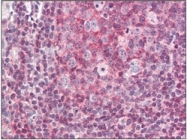 AP32225PU-N - FAK2 / PTK2B