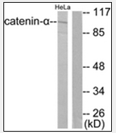AP32230PU-N - Catenin alpha-1 / CTNNA1