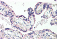 AP32234PU-N - GLUT1 / SLC2A1