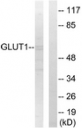 AP32234PU-N - GLUT1 / SLC2A1