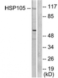 AP32237PU-N - Heat shock protein 105 / HSP105