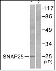 AP32238PU-N - SNAP25