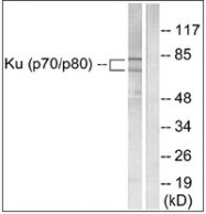 AP32239PU-N - Ku70/80 (XRCC6/5)