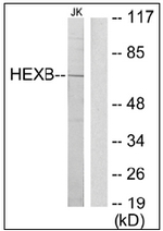 AP32247PU-N - Beta-hexosaminidase beta / HEXB