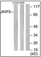 AP32249PU-N - JAKMIP2
