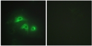 AP32254PU-N - Adenylate kinase 1 / AK1