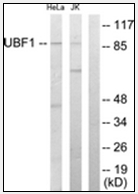 AP32257PU-N - UBTF / UBF