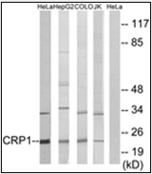AP32258PU-N - CSRP1