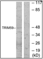 AP32270PU-N - TRIM59 / TSBF1 / RNF104