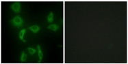 AP32279PU-N - Isoleucyl-tRNA synthetase / IARS2