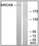 AP32283PU-N - CDC42BPB