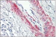AP32283PU-N - CDC42BPB