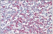 AP32295PU-N - ATP5G2