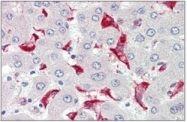 AP32295PU-N - ATP5G2