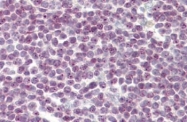 AP32313PU-N - OXR1