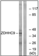 AP32315PU-N - ZDHHC9