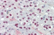 AP32323PU-N - TCEAL3
