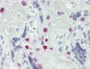 AP32324PU-N - TCEAL4