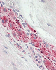 AP32329PU-N - RAB3GAP1 / RAB3GAP