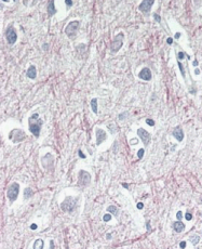 AP32333PU-N - TAO Kinase 1 (TAOK1)