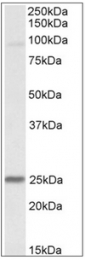 AP32342PU-N - NDUFS8