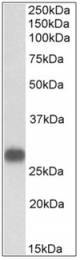 AP32345PU-N - Cardiac Troponin I
