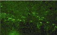 AP32556SU-N - Neurotrophin 3 / NTF3
