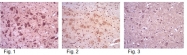 AP32558SU-N - CRMP1 / DPYSL1