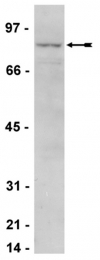 AP32594PU-N - IKBKE / IKKE