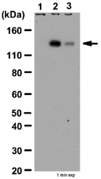 AP32617PU-N - Tyrosine-protein kinase JAK2