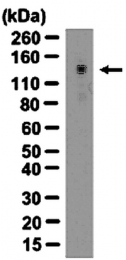 AP32617PU-N - Tyrosine-protein kinase JAK2