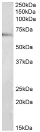 AP32701PU-N - Adapter protein CIKS
