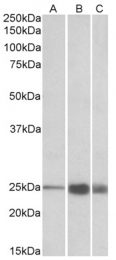 AP32706PU-N - Fast skeletal muscle Troponin I
