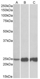 AP32708PU-N - Fast skeletal muscle Troponin I