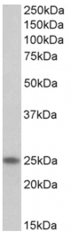 AP32709PU-N - Skeletal muscle Troponin I