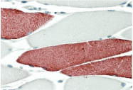 AP32711PU-N - Fast skeletal muscle Troponin T