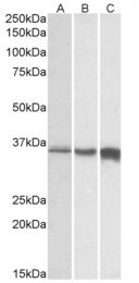 AP32711PU-N - Fast skeletal muscle Troponin T