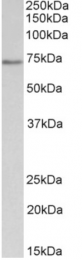 AP32719PU-N - CDC6