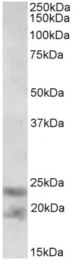 AP32729PU-N - Interleukin-25 / IL25