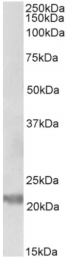 AP32730PU-N - Interleukin-25 / IL25