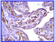 AP32742PU-N - PPP3R1 / Calcineurin B