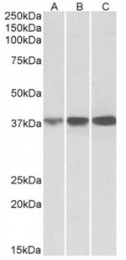 AP32798PU-N - Isocitric dehydrogenase alpha / IDH3A