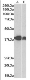 AP32798PU-N - Isocitric dehydrogenase alpha / IDH3A