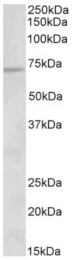 AP32801PU-N - ACADVL