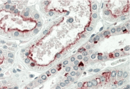 AP32808PU-N - MAPKAP Kinase-5