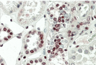 AP32809PU-N - MAPKAP Kinase-5