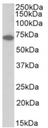 AP32813PU-N - IFNAR1