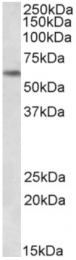 AP32818PU-N - PLK1