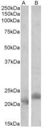 AP32825PU-N - CARD5 / PYCARD / ASC